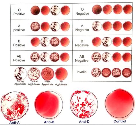 analyzer lab blood typing|where to check blood type.